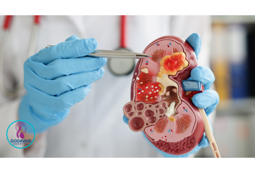 Best Urology Hospital in Rajahmundry – Godavari Hospital Urology and urinary tract treatment at Godavari Hospital Rajahmundry